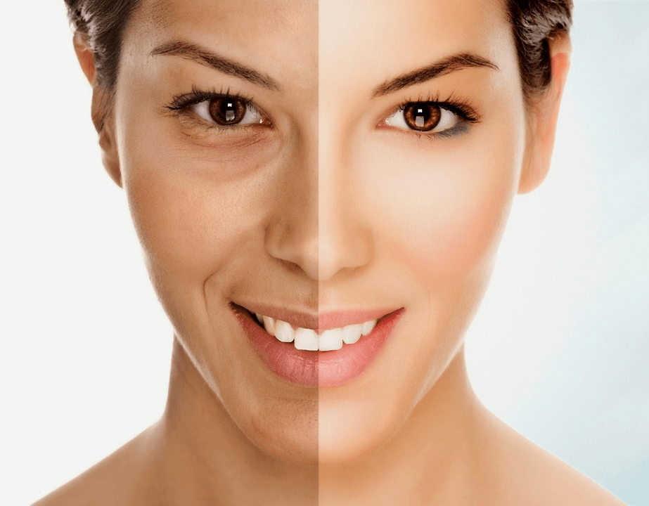 Intensive skin for facial rejuvenation