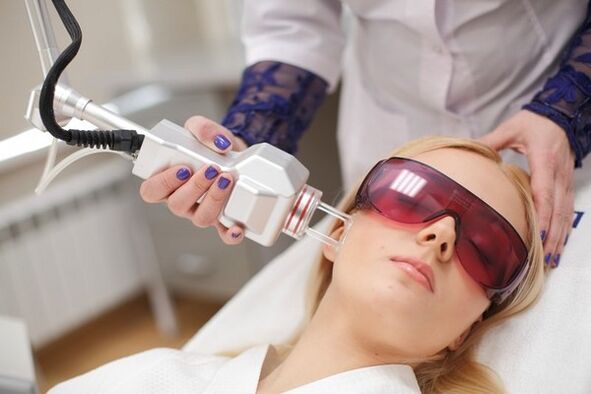 Laser rejuvenation of the face