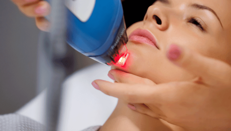 Rejuvenation of the skin