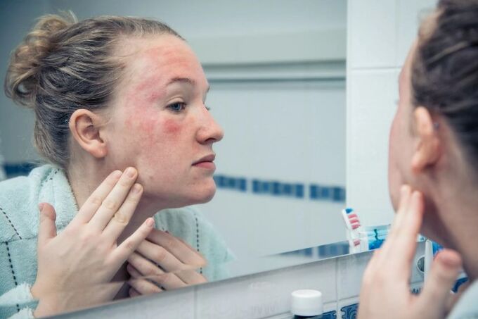 Chronic skin diseases in the development of the complication