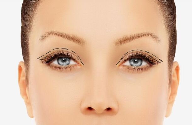 Outline of eyelids