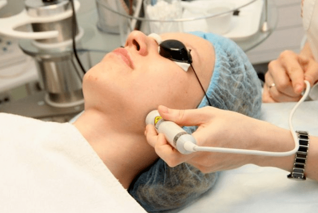 Laser borevization