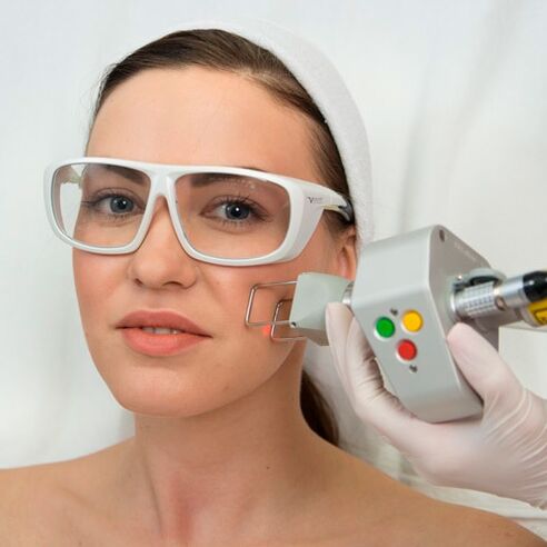 Procedure to view
